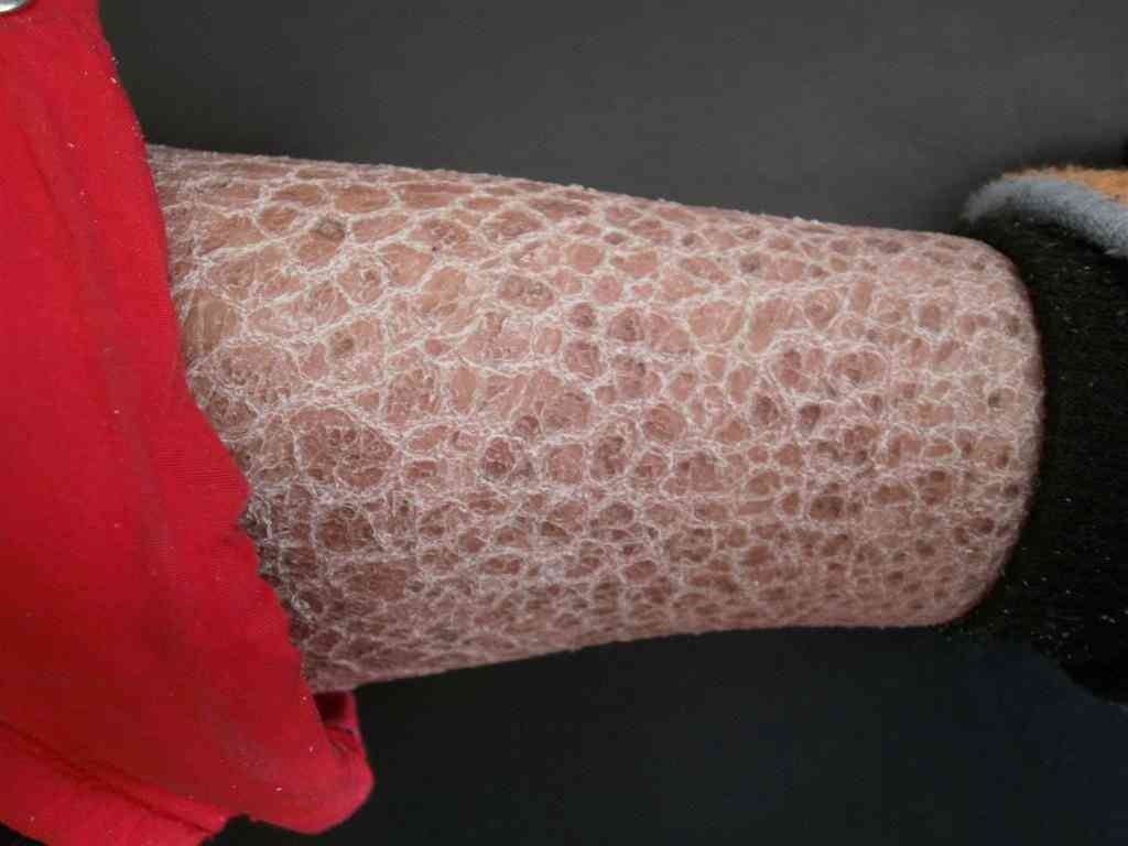 如懿传火棉胶婴儿图片